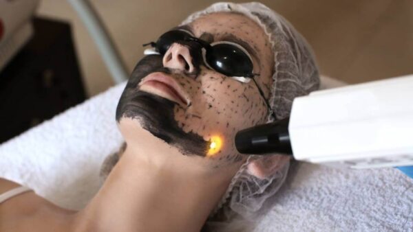 Black Doll Charcoal Laser Treatment (30 min)