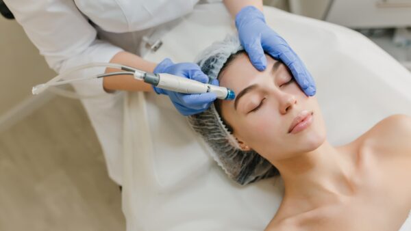 Melasma Treatment (PICO Laser) (60 min)